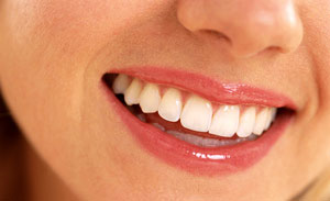 Maple Ridge Teeth Whitening