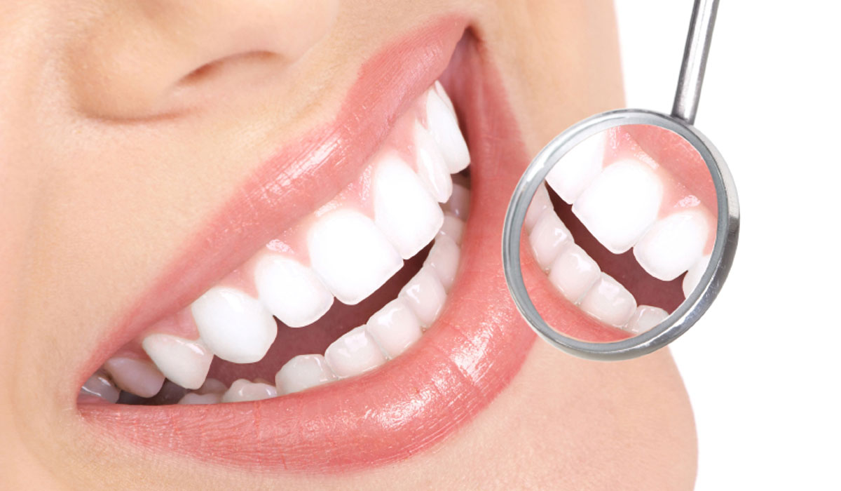 Teeth Whitening Maple Ridge