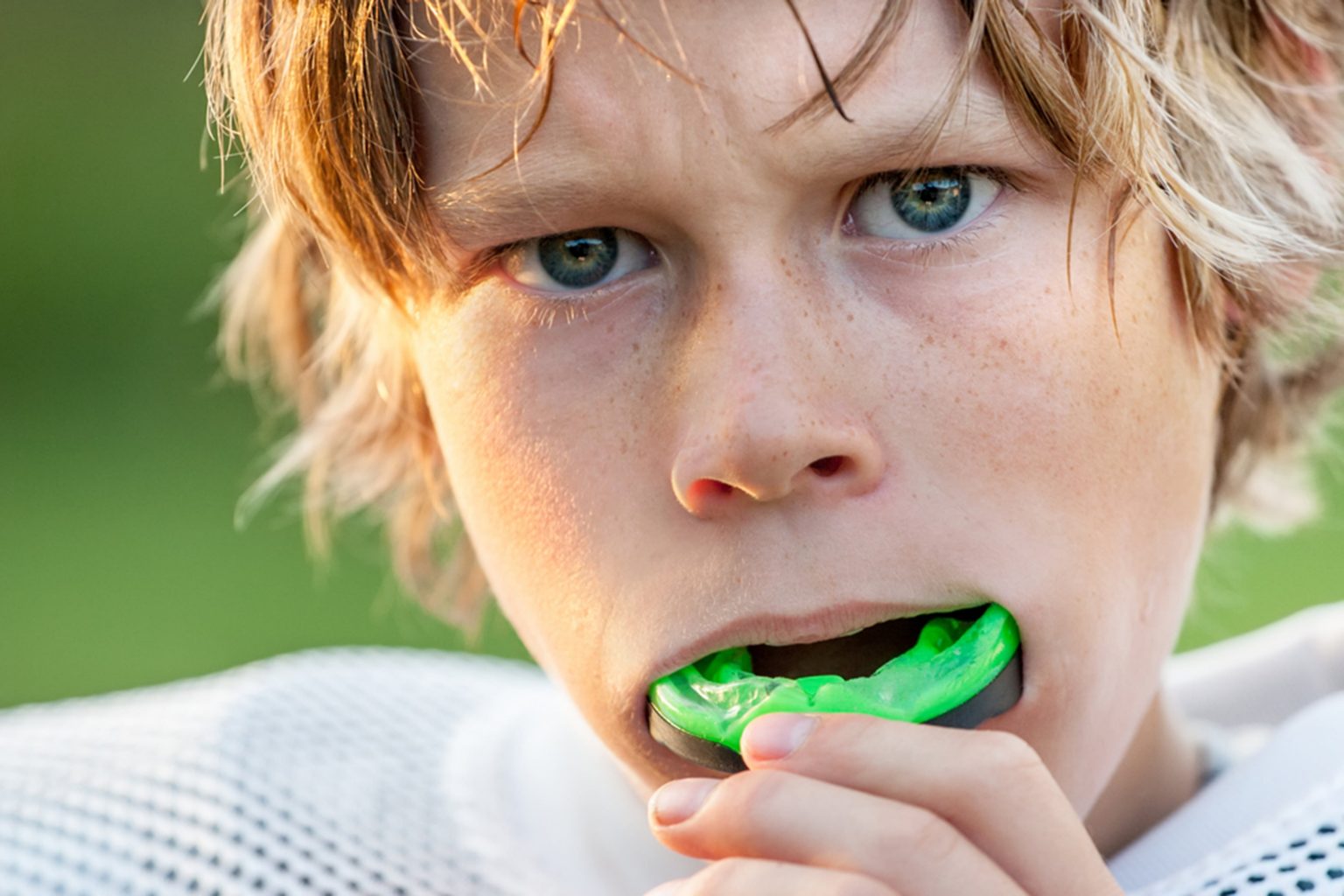 mouth guards in maple ridge