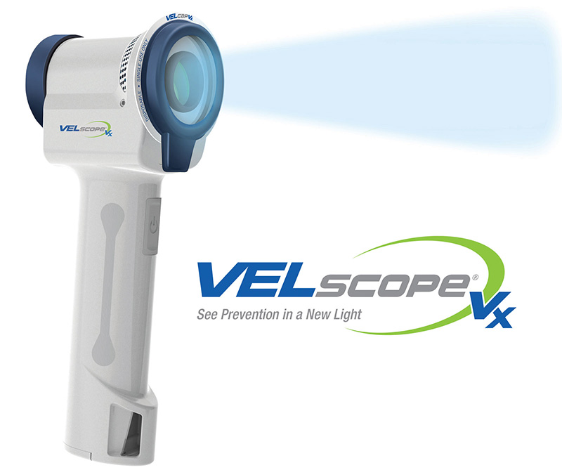 VELscope Oral Cancer Screening